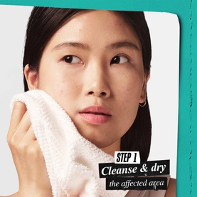 Acne Clearing Patch P22
