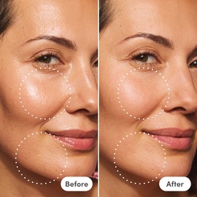 Miracle Blur Diffuser Texture and Line Smoother