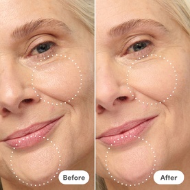 Miracle Blur Diffuser Texture and Line Smoother