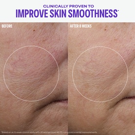Paula's Choice serum before and after comparison showing improved skin smoothness on cheek area after 8 weeks of use