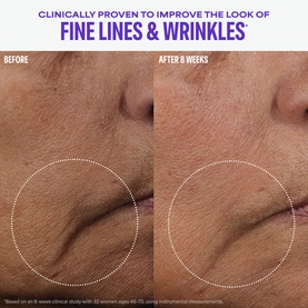 Paula's Choice serum before and after comparison showing reduced fine lines and wrinkles around the mouth area after 8 weeks of use