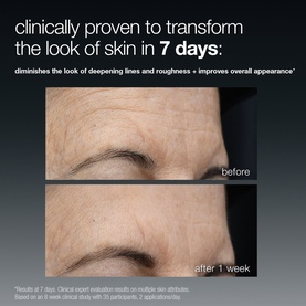 Dermalogica serum before and after results showing reduced eye area lines and roughness after 7 days of use