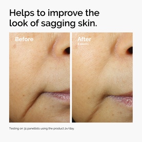 The Ordinary serum before-and-after close-up showing improved skin firmness and reduced sagging after 4 weeks of use.