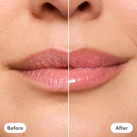 Trinny London The Lip Reset Kit before and after lip close-up showing visibly fuller, glossier lips post-application