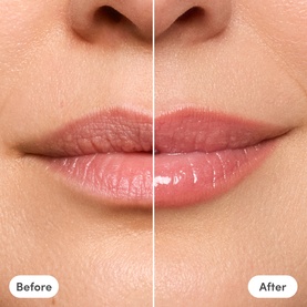 Trinny London The Lip Reset Kit before and after: lips appear fuller and glossier with improved hydration and definition.