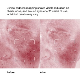 Clinique clinical redness mapping showing before and after comparison on skin after 2 weeks of use, with visible reduction on cheeks, nose, and
