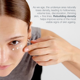 Model with Dermalogica Eye Serum applied as dots beneath the eye, demonstrating undereye placement technique on bare skin.