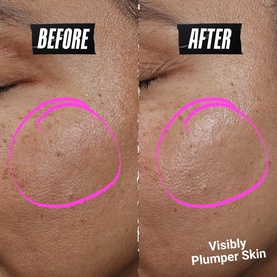 Kiehl's Collagen Serum before and after comparison showing visibly plumper, smoother skin on cheek after use.