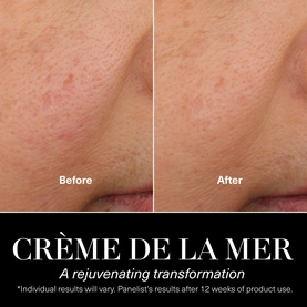 La Mer Eye Renewal & Hydration Gift Set before and after skincare transformation showing visible skin improvement after 12 weeks of use.