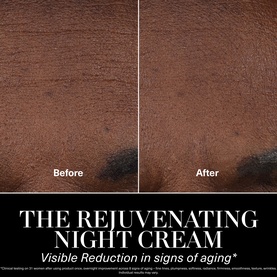 La Mer Rejuvenating Anti-Ageing Skincare Gift Set before and after close-up showing visible reduction in signs of ageing on skin