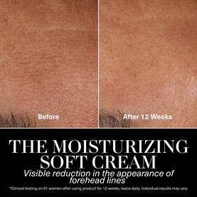 La Mer Moisturizing Soft Cream before-and-after showing visible reduction in forehead lines after 12 weeks of use
