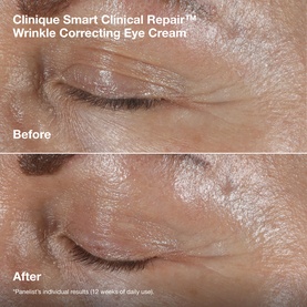 Clinique Smart Clinical Repair&trade; Wrinkle Correcting Eye Cream before and after close-up showing reduced under-eye wrinkles after 12 weeks of use.