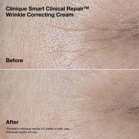 Clinique Smart Clinical Repair&trade; Wrinkle Correcting Cream before and after close-up showing reduced wrinkles after 12 weeks of use