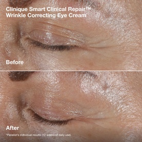 Clinique Smart Clinical Repair&trade; Wrinkle Correcting Eye Cream before and after close-up showing reduced eye area wrinkles after 12 weeks of use.