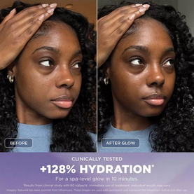 Before and after split image showing skin hydration results, with improved glow visible after treatment. Text states +128% hydration in 10 minutes.