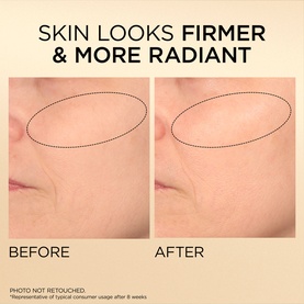 Elizabeth Arden Advanced Gold Ceramide Capsules serum before and after comparison showing visibly firmer, more radiant skin after 8 weeks