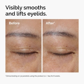 Before and after close-up showing The Ordinary Eye Cream/Gel results on eyelids, with visibly smoother and lifted appearance after 8 weeks.