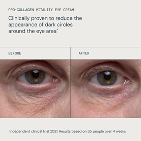 Elemis Pro-Collagen Vitality Eye Cream before and after close-up showing reduced dark circles around the eye area after 4 weeks
