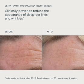 Elemis Ultra Smart Midnight Renewal Gift Set before and after results showing reduced appearance of deep-set lines and wrinkles over 4 weeks.