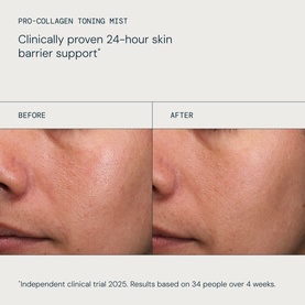 Elemis Refresh & Replenish Gift Set before and after skin results showing improved texture and barrier support after 4 weeks