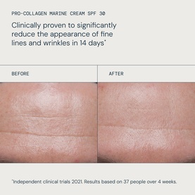Elemis Pro-Collagen Marine Cream SPF 30 before and after clinical results showing reduced fine lines and wrinkles after 14 days