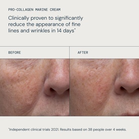 Elemis Pro-Collagen Marine Cream before and after close-up showing reduced fine lines and wrinkles after 14 days of use.