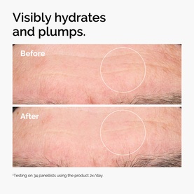 The Ordinary skincare before and after close-up showing visibly hydrated and plumped skin after product use.
